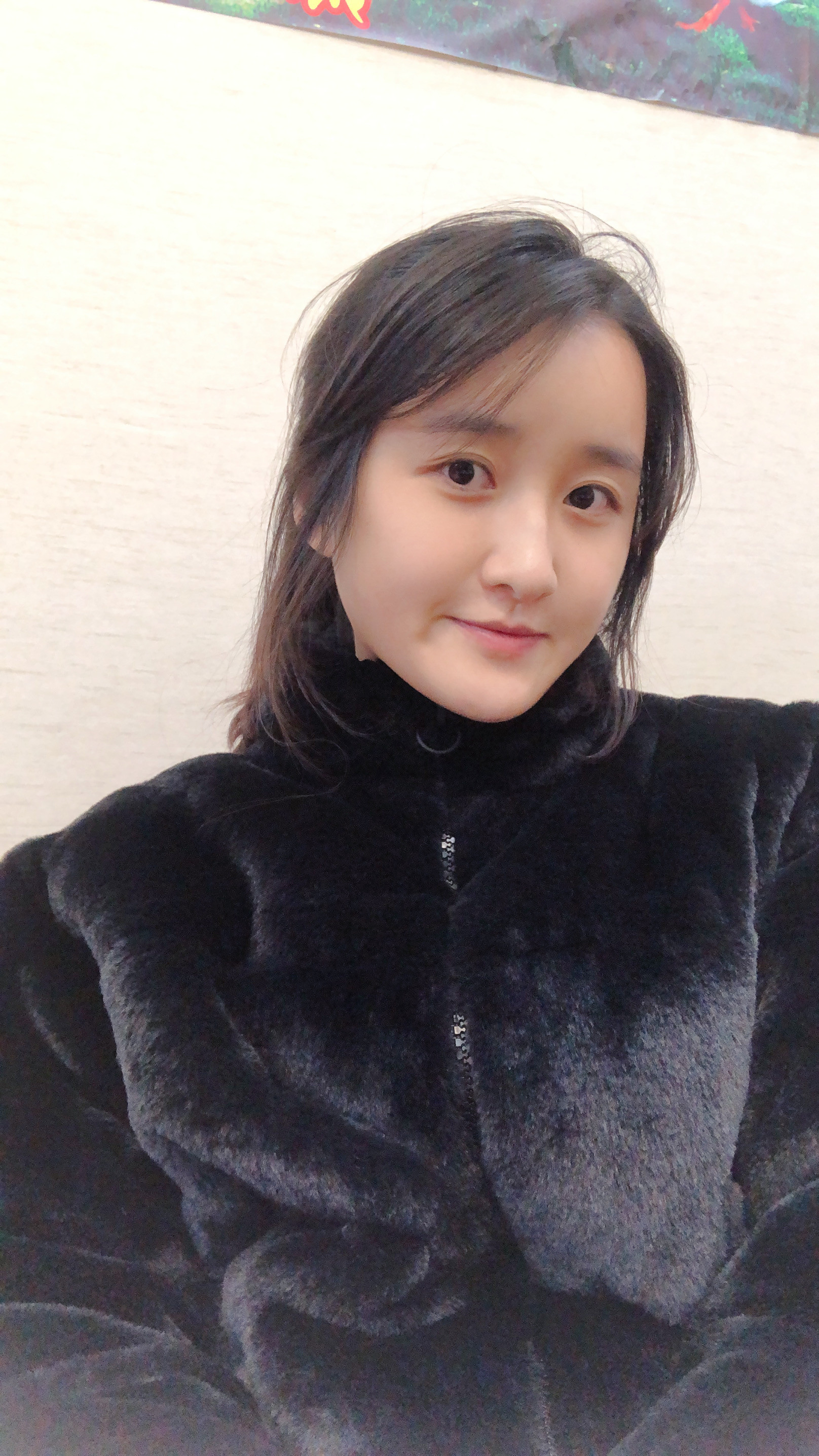 自体脂肪填充术