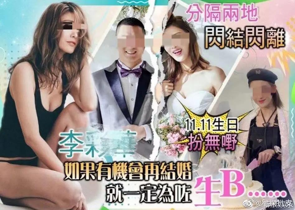 面部提升术