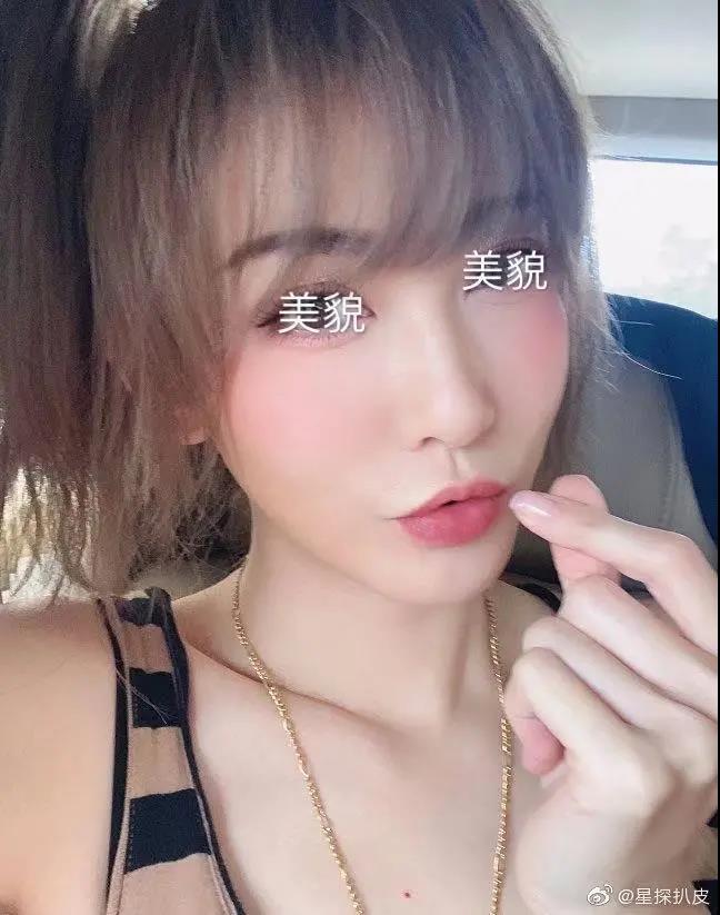 面部提升术