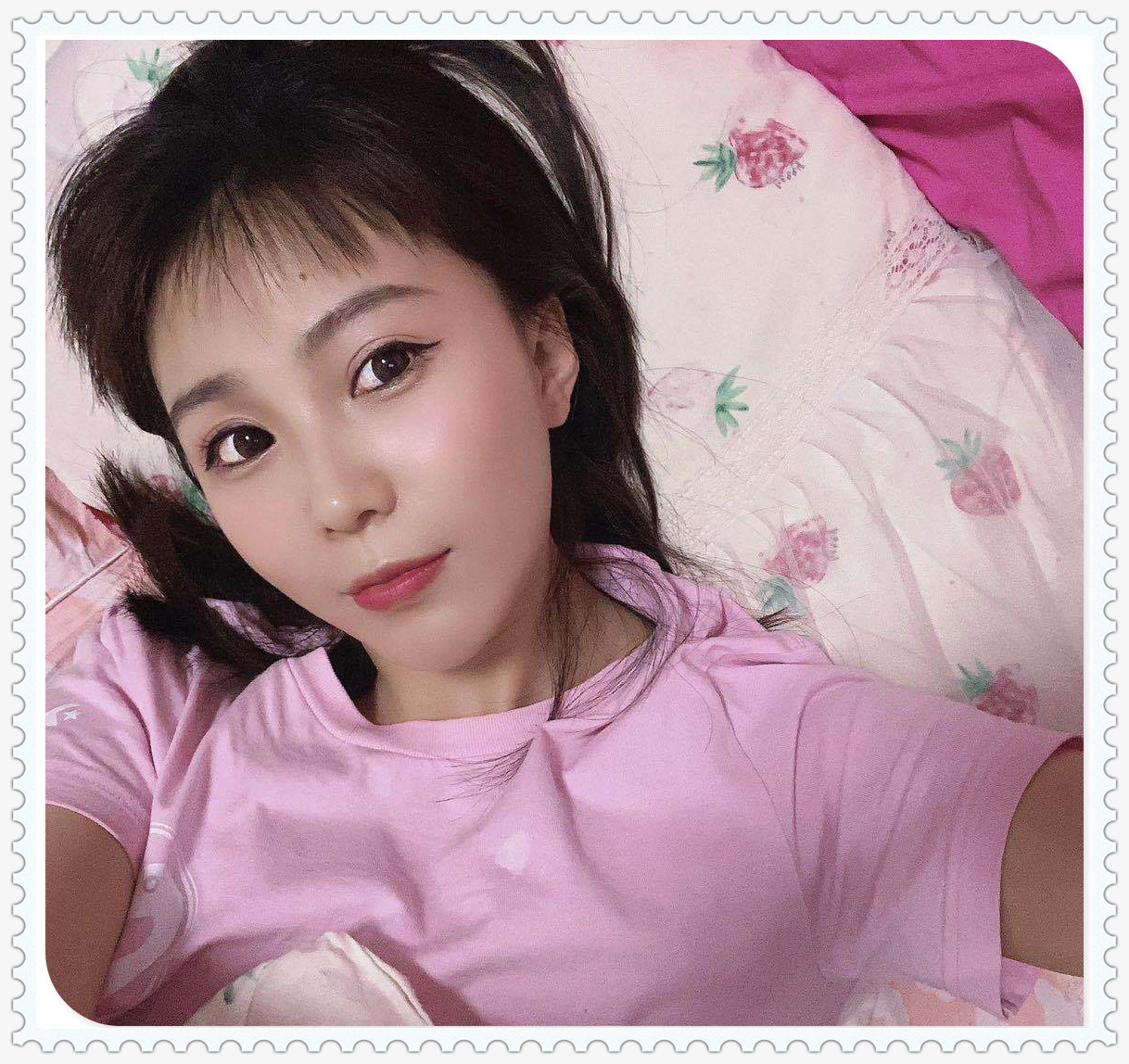 面部提升术
