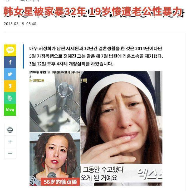 面部提升术