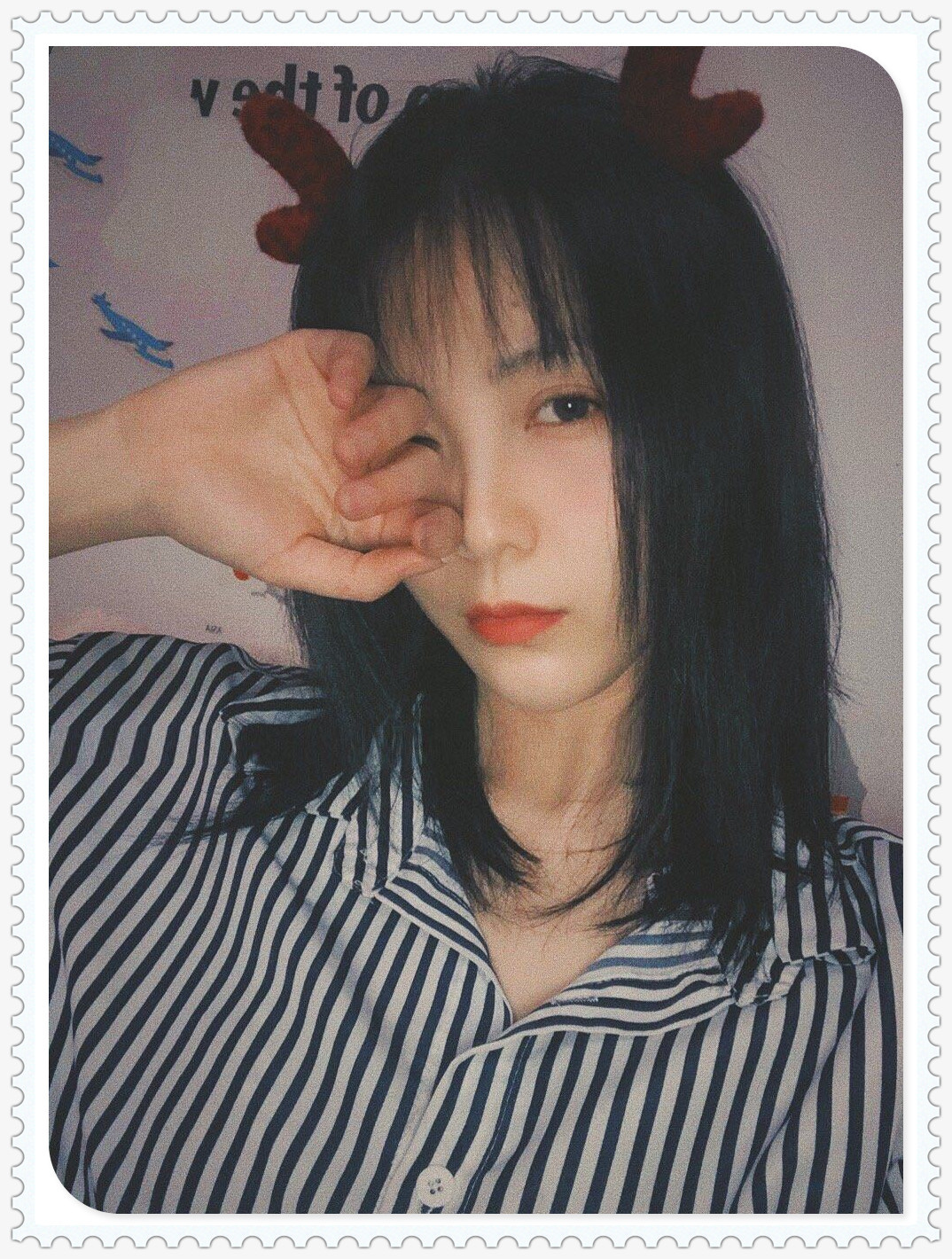 面部提升术