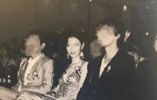 超声波瘦脸