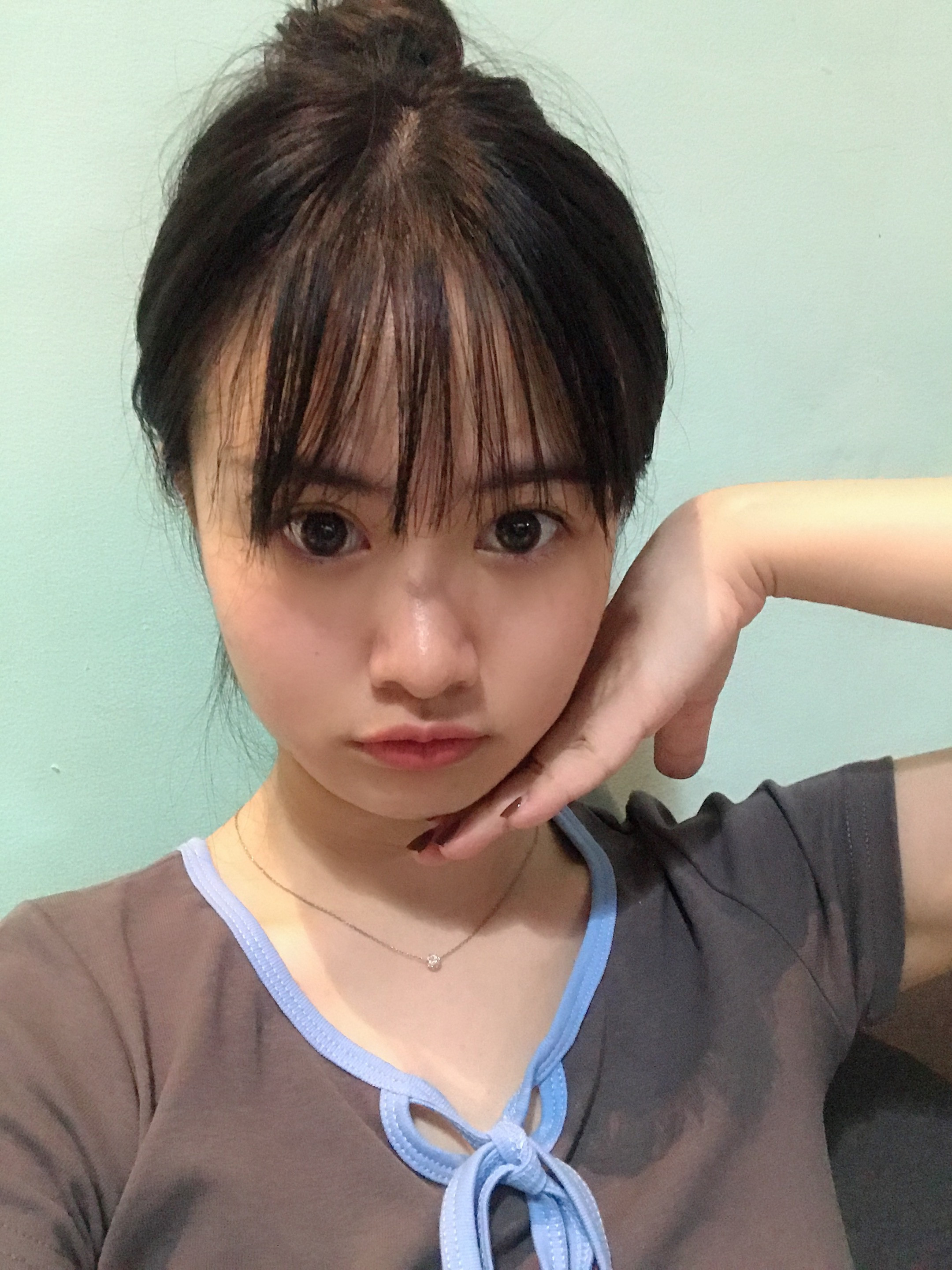 超声波瘦脸