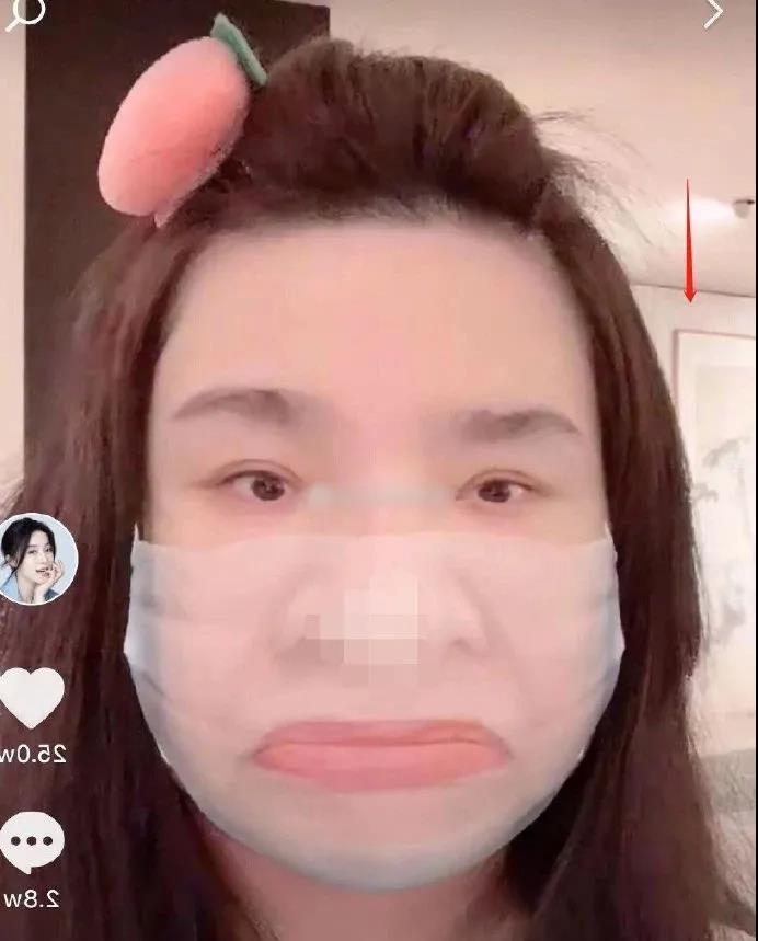 双眼皮手术