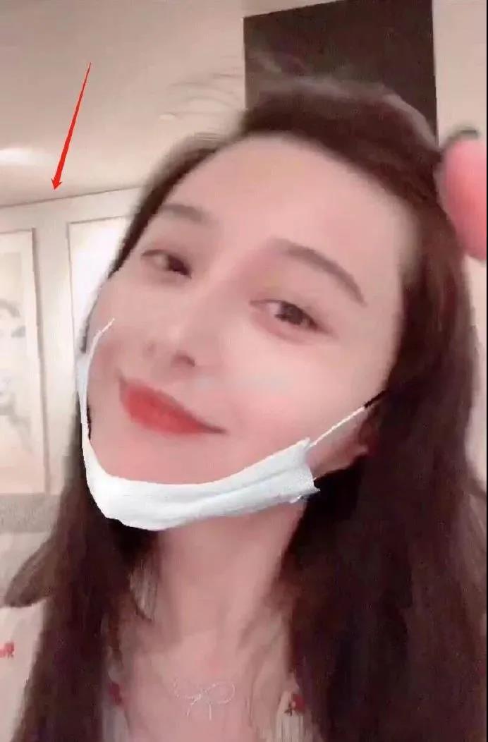 双眼皮手术