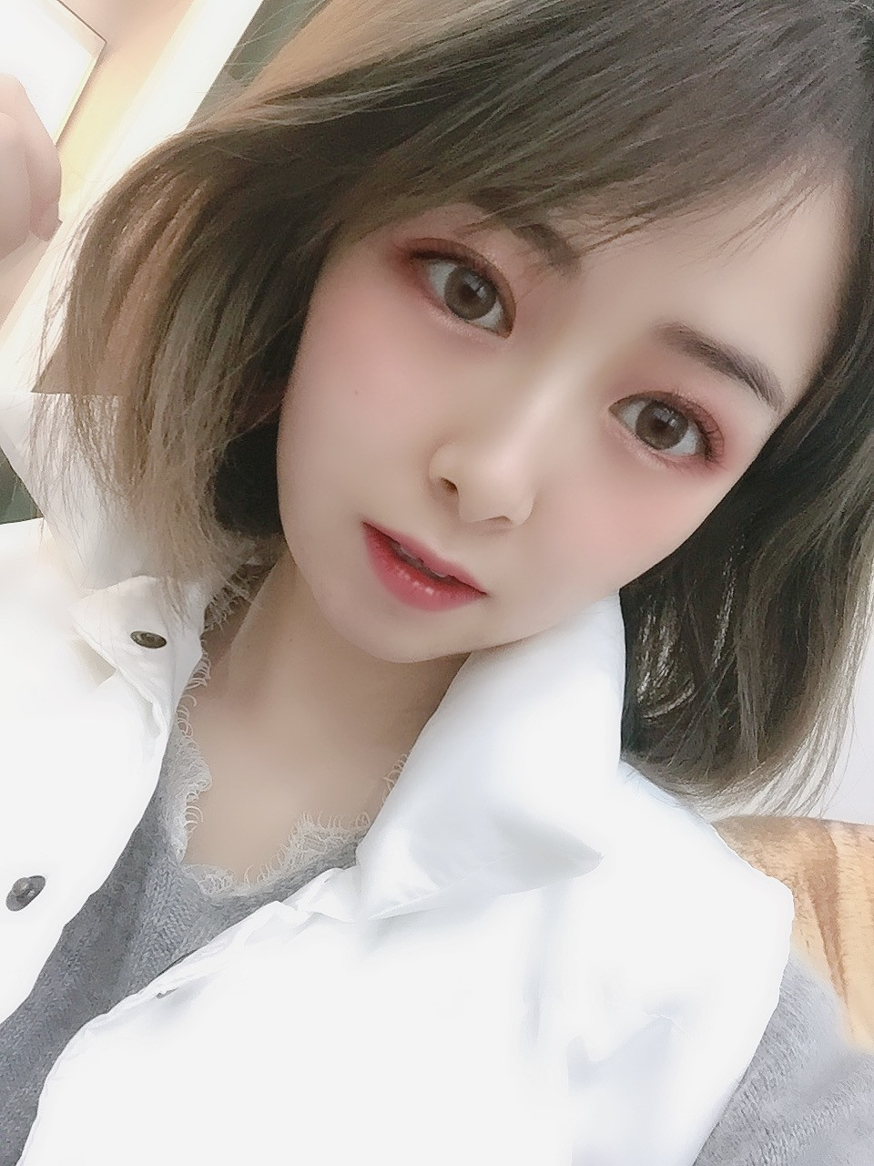 双眼皮手术