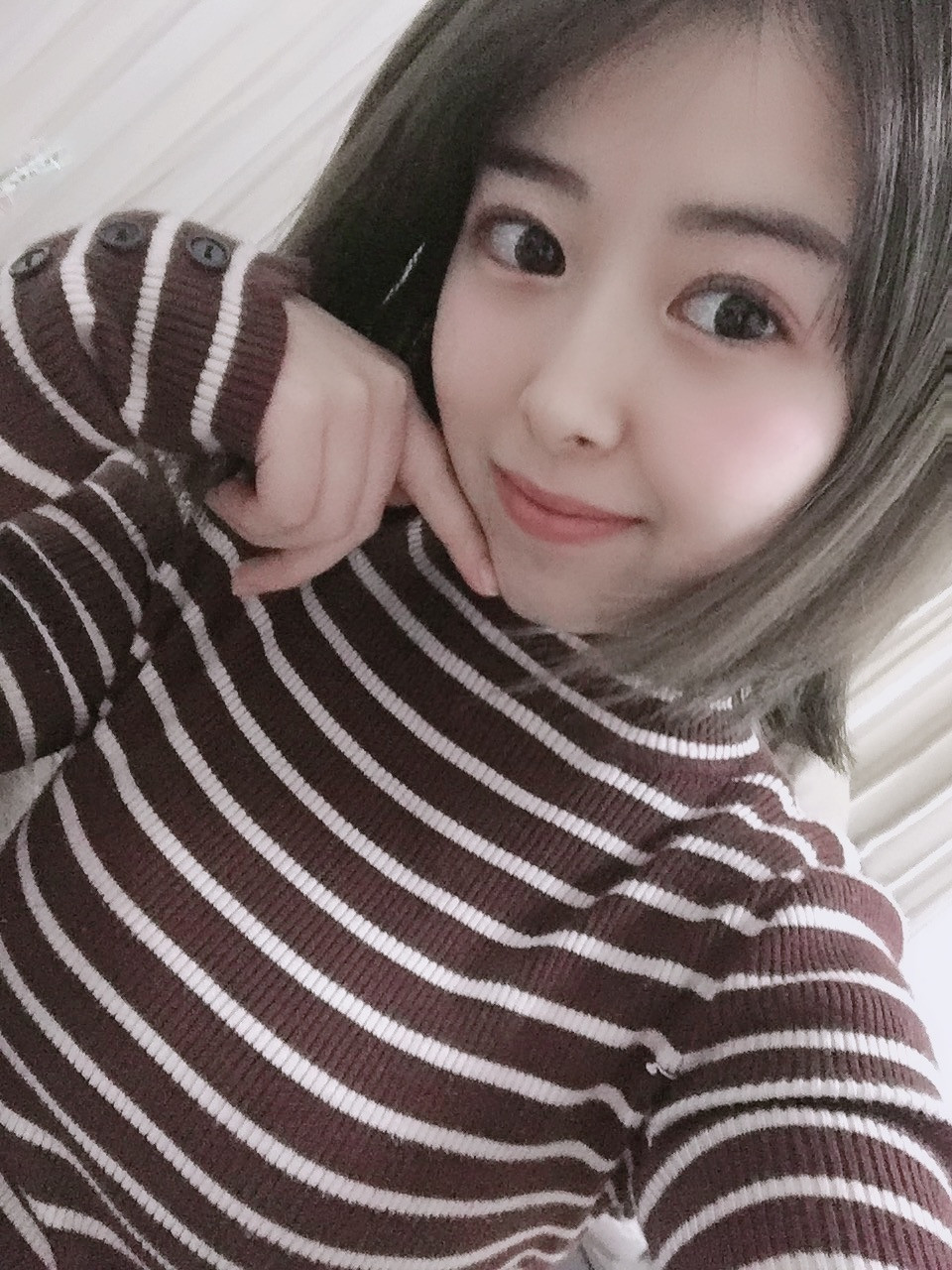 双眼皮手术