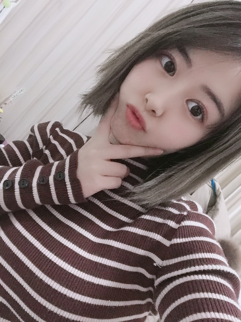 双眼皮手术
