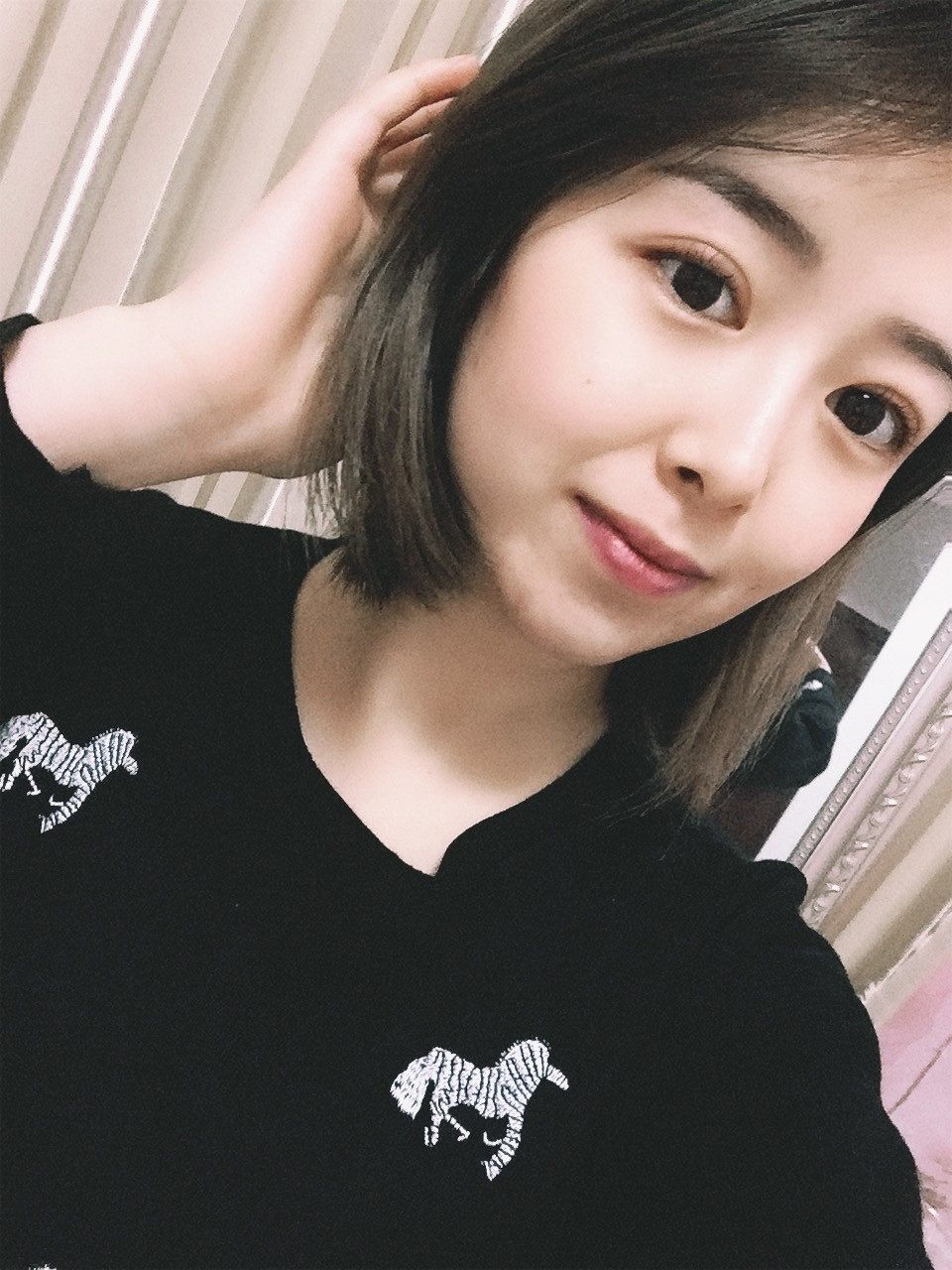 双眼皮手术