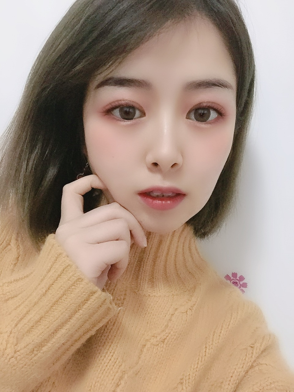 双眼皮手术