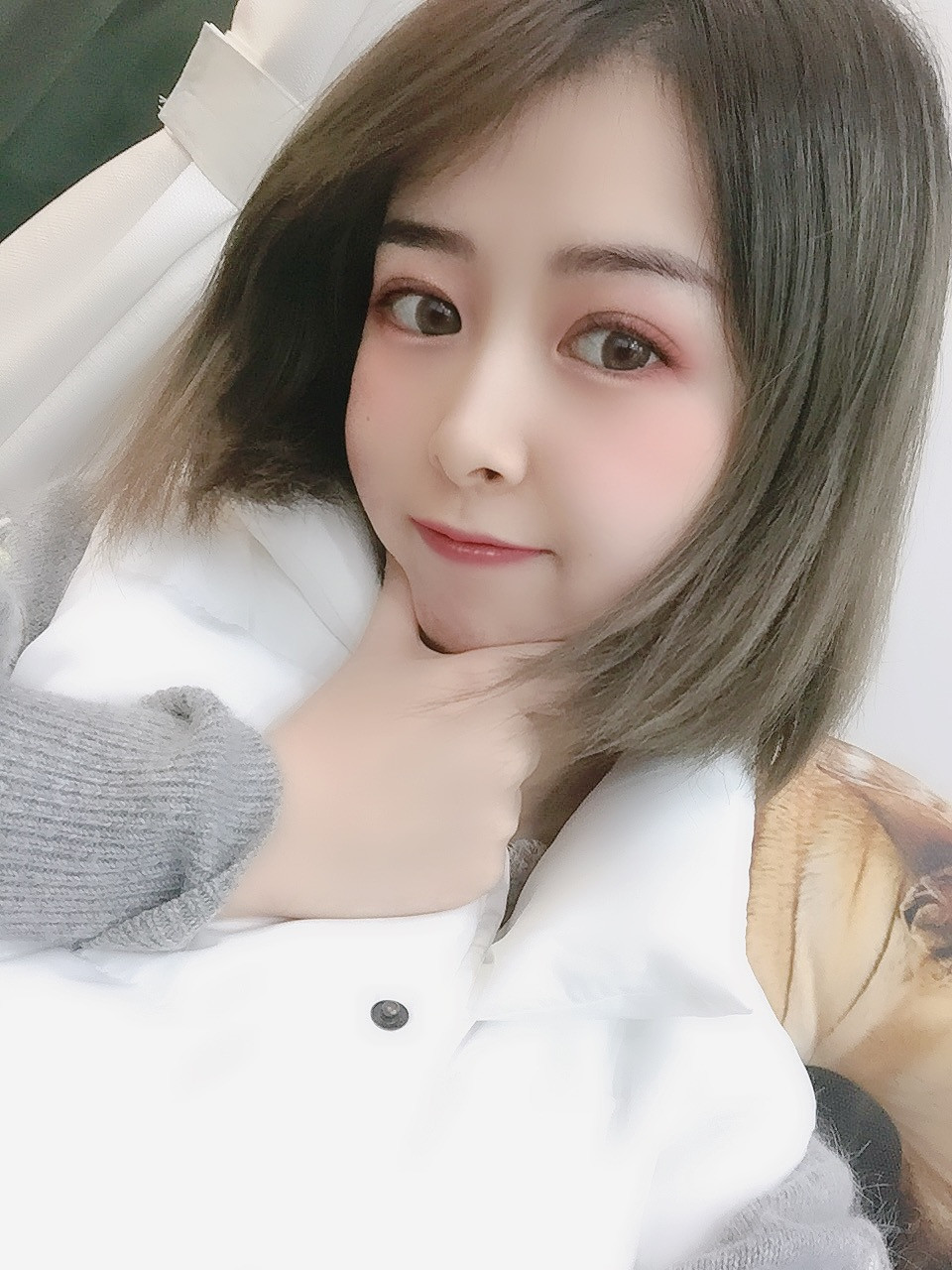 双眼皮手术