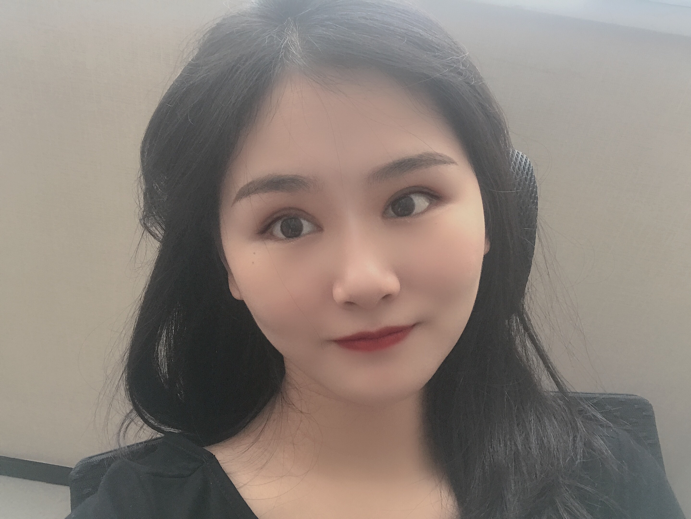 双眼皮手术