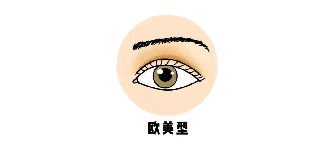 双眼皮手术