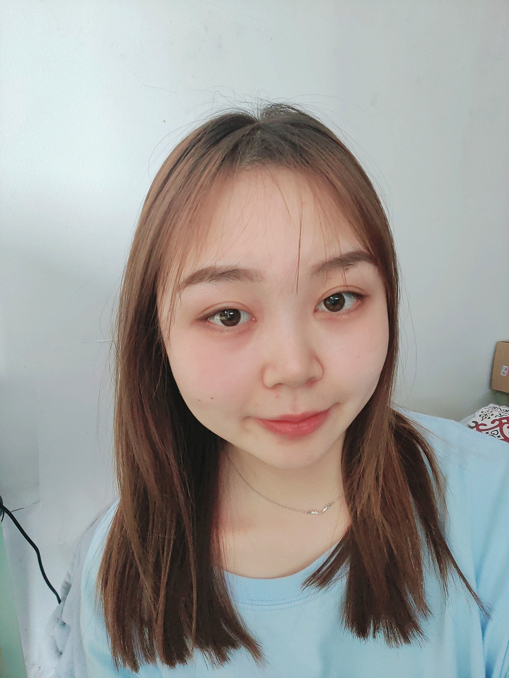 双眼皮手术