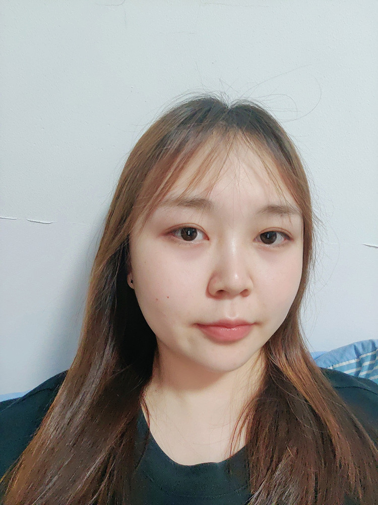 双眼皮手术