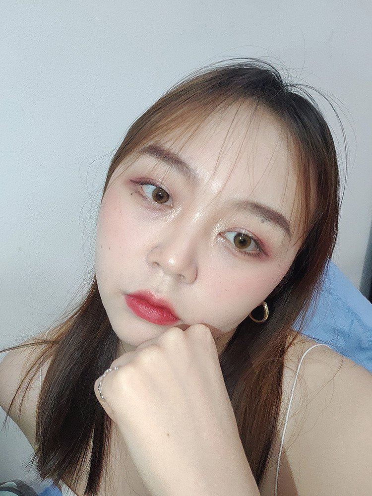 双眼皮手术