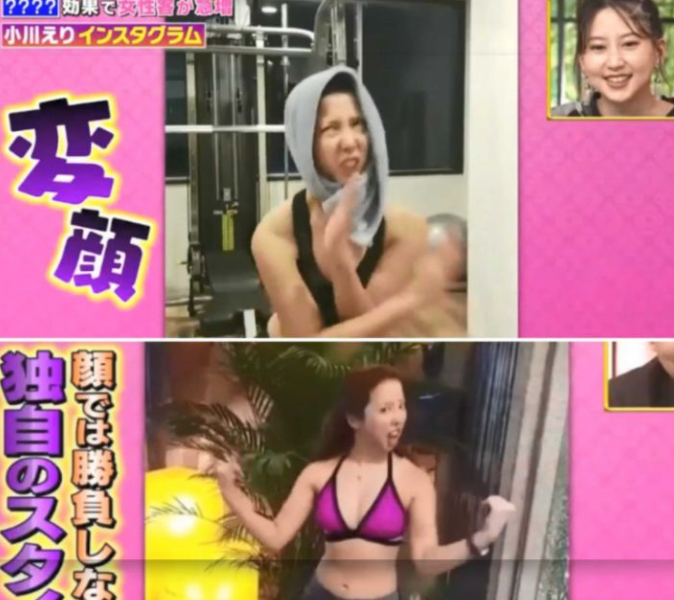 双眼皮手术