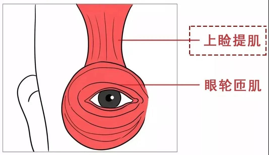 双眼皮手术