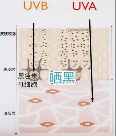 祛斑手术哪家强?超皮秒祛斑管用吗?327 祛斑手术哪家强?超皮秒祛斑管用吗?327