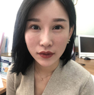 双眼 皮手术后眼部形态不好看怎么办?来看双眼 双眼 皮手术后眼部形态不好看怎么办?来看双眼