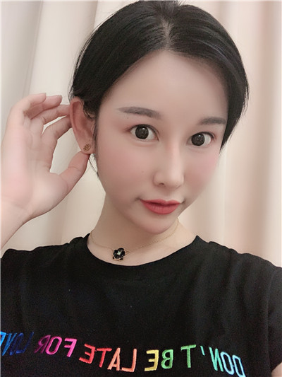 双眼 皮手术后眼部形态不好看怎么办?来看双眼 双眼 皮手术后眼部形态不好看怎么办?来看双眼