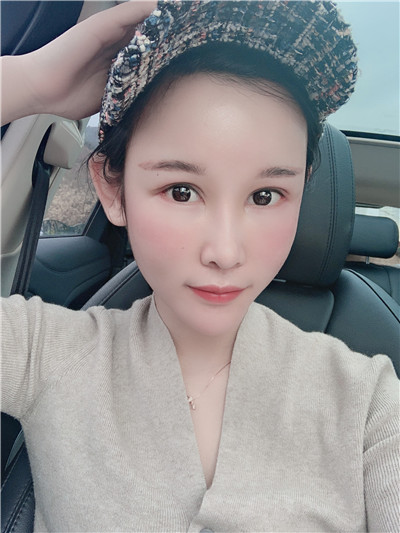 双眼 皮手术后眼部形态不好看怎么办?来看双眼 双眼 皮手术后眼部形态不好看怎么办?来看双眼