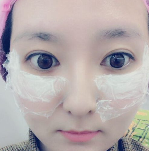 【去眼袋手术】别再顶着大眼袋熬夜追剧啦~ 【去眼袋手术】别再顶着大眼袋熬夜追剧啦~
