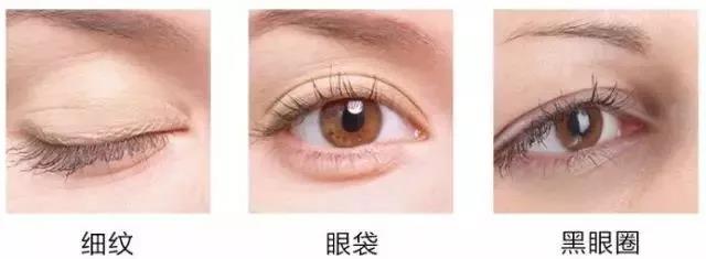 令人无法抗拒得眼周抗衰——不动刀去眼袋手术 令人无法抗拒得眼周抗衰——不动刀去眼袋手术
