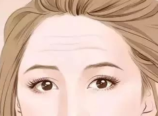 令人无法抗拒得眼周抗衰——不动刀去眼袋手术 令人无法抗拒得眼周抗衰——不动刀去眼袋手术