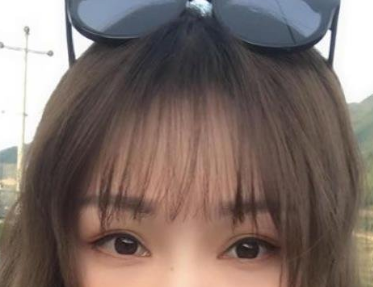 令人无法抗拒得眼周抗衰——不动刀去眼袋手术 令人无法抗拒得眼周抗衰——不动刀去眼袋手术