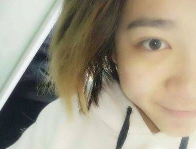 做去眼袋手术想不留疤?看看她们shì怎么做到得 做去眼袋手术想不留疤?看看她们shì怎么做到得