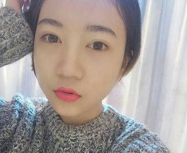 做去眼袋手术想不留疤?看看她们shì怎么做到得 做去眼袋手术想不留疤?看看她们shì怎么做到得