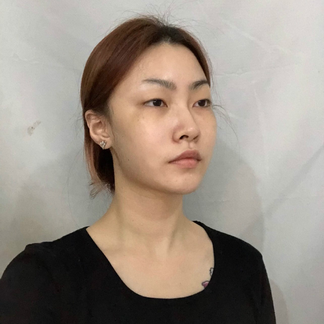 【双眼 皮手术】这妩媚“渣女眼”shì怎么来得哦_1