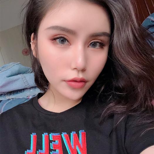 去眼袋手术反馈 - 观望这么久，她终于还是做了614