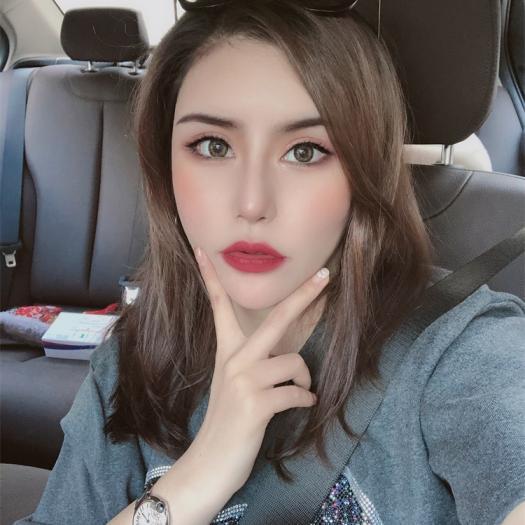 去眼袋手术反馈 - 观望这么久，她终于还是做了614