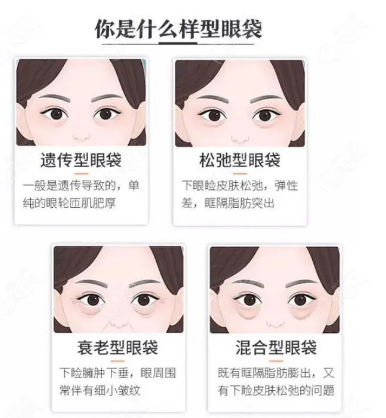 去眼袋手术