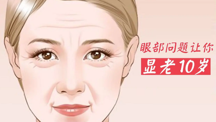 去眼袋手术