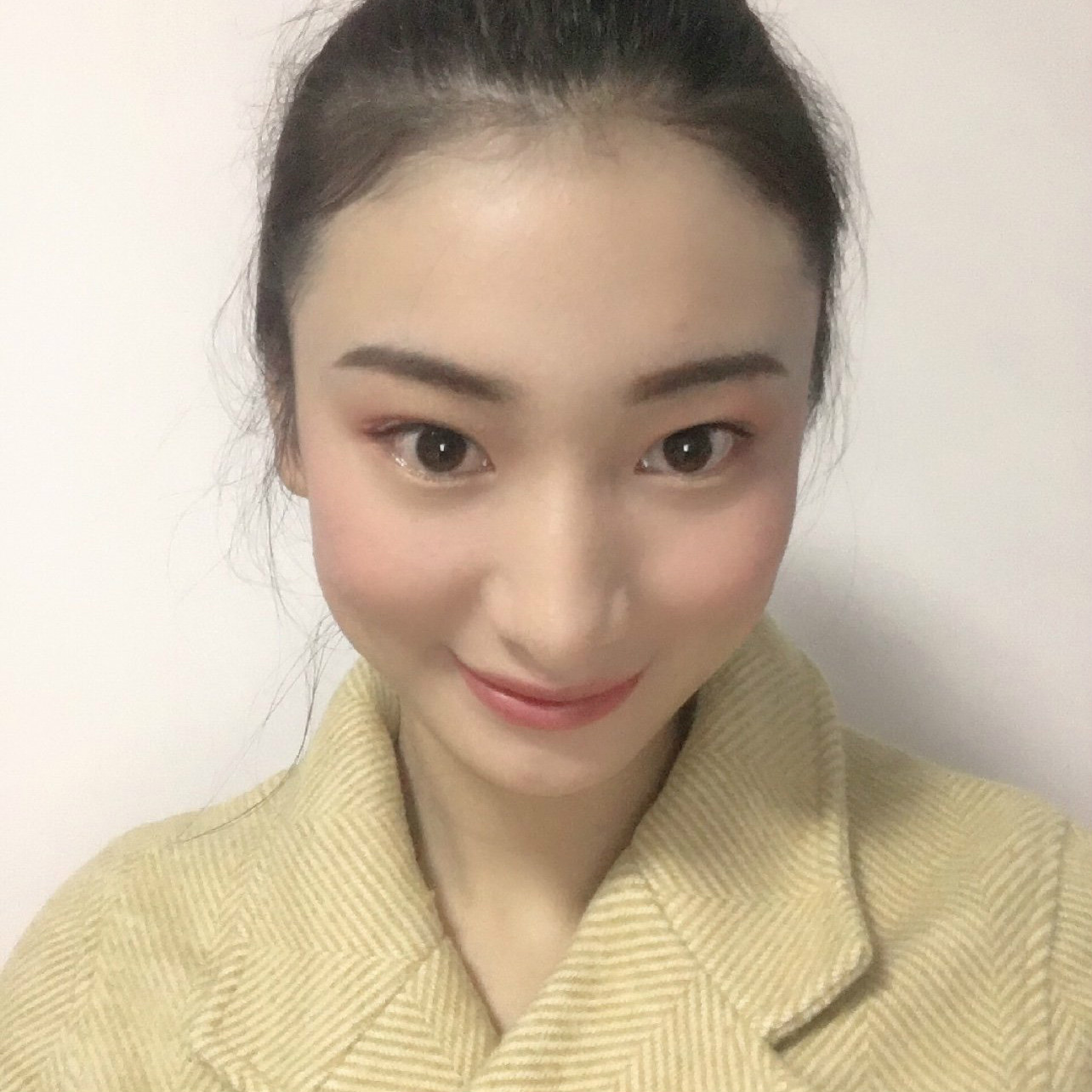 去眼袋手术