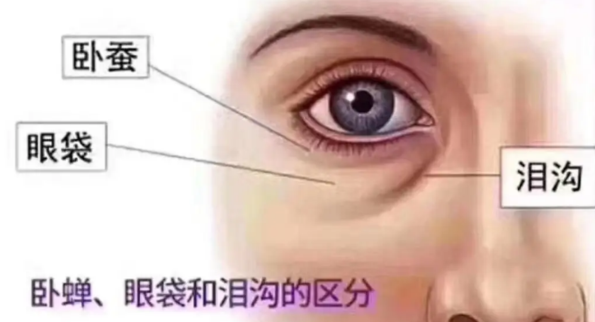 去眼袋手术