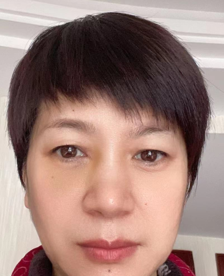 去眼袋手术