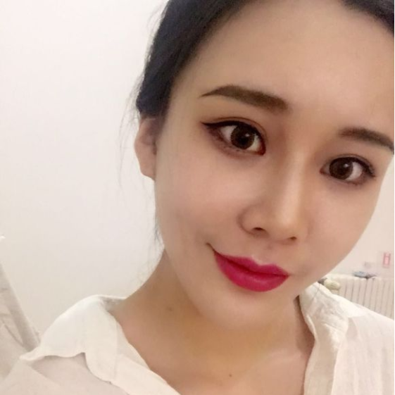 去眼袋手术