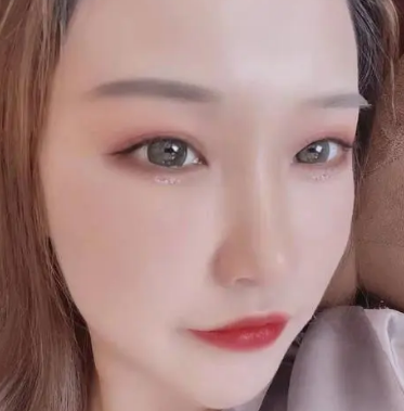 谁也不想做双眼皮手术修复!所以得认真选择术931 谁也不想做双眼皮手术修复!所以得认真选择术931