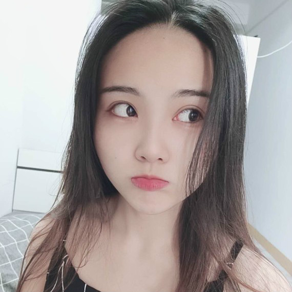谁也不想做双眼皮手术修复!所以得认真选择术931 谁也不想做双眼皮手术修复!所以得认真选择术931