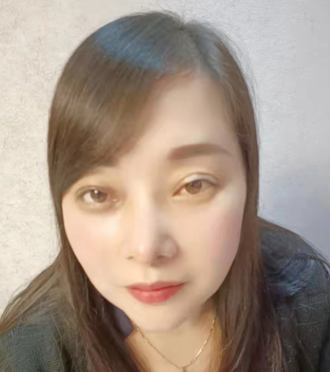 34岁才决定做眼袋,晚不晚?效果怎样?194 34岁才决定做眼袋,晚不晚?效果怎样?194