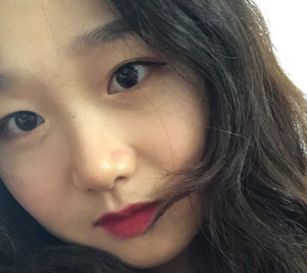 超声波复合双眼皮多久恢复自然?10天之内吗?624 超声波复合双眼皮多久恢复自然?10天之内吗?624