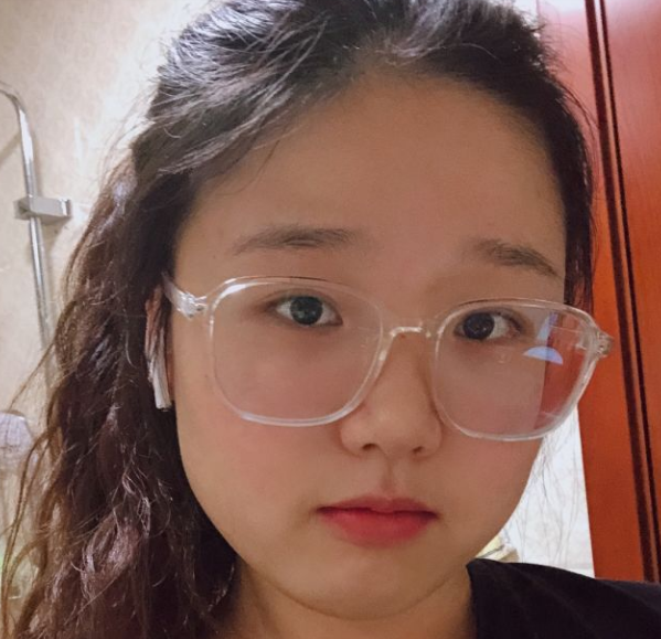超声波复合双眼皮多久恢复自然?10天之内吗?624 超声波复合双眼皮多久恢复自然?10天之内吗?624