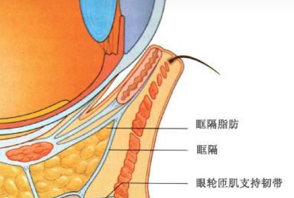 去眼袋手术