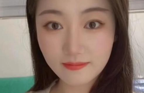 双眼皮手术
