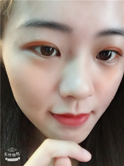 双眼皮手术